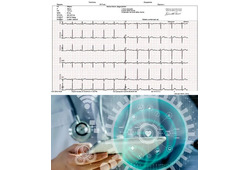 Elettrocardiogramma Veloce 15' con Referto da Medico Specialista