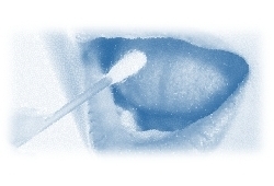 test HPV cavo orale autoprelievo